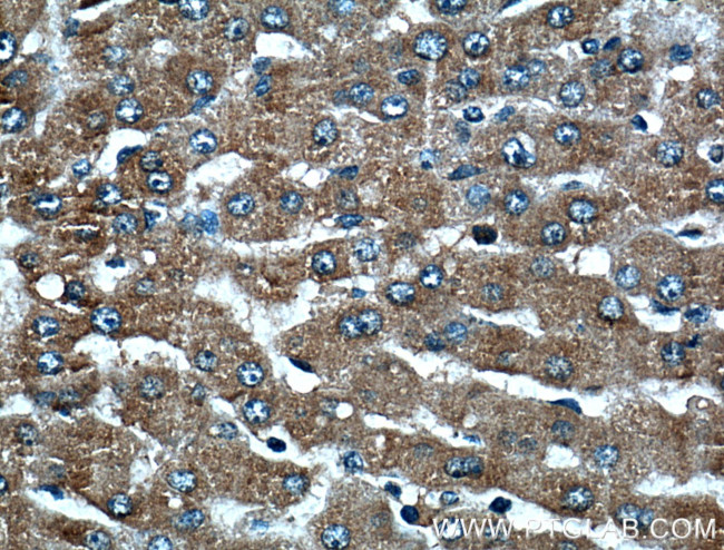 VDAC2 Antibody in Immunohistochemistry (Paraffin) (IHC (P))