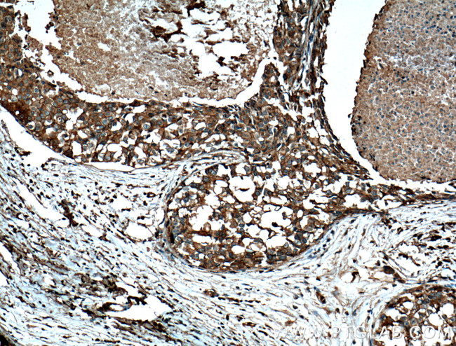 FKBPL Antibody in Immunohistochemistry (Paraffin) (IHC (P))