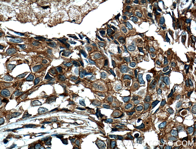 FKBPL Antibody in Immunohistochemistry (Paraffin) (IHC (P))