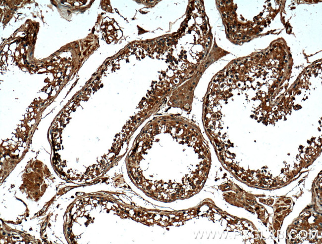 FKBPL Antibody in Immunohistochemistry (Paraffin) (IHC (P))