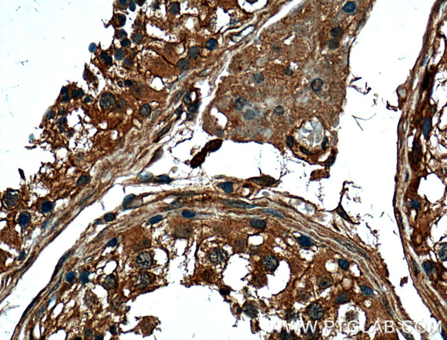 FKBPL Antibody in Immunohistochemistry (Paraffin) (IHC (P))