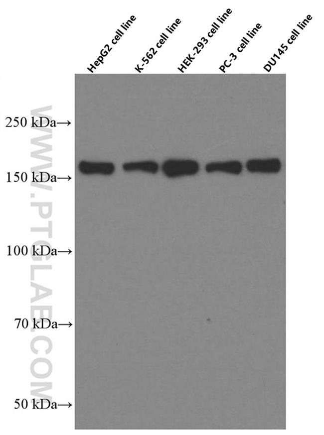 VPRBP Antibody in Western Blot (WB)