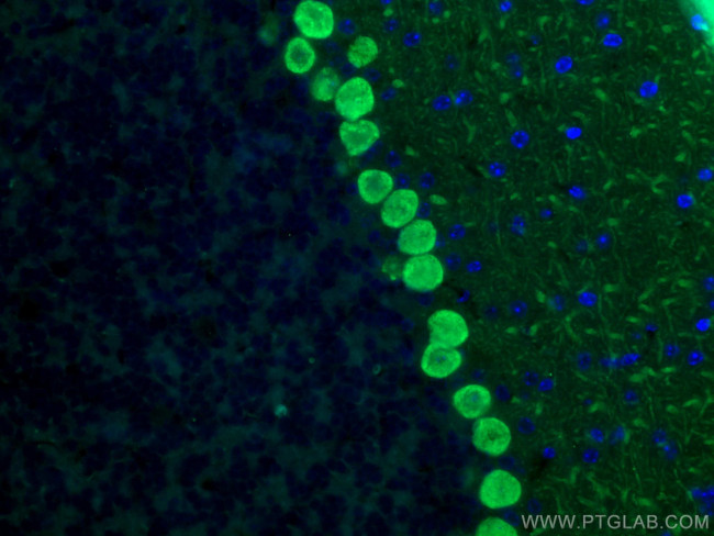 Calbindin-D28k Antibody in Immunohistochemistry (PFA fixed) (IHC (PFA))