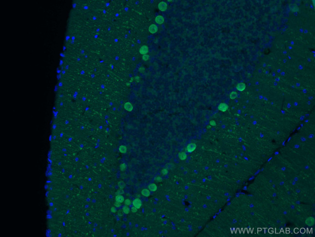 Calbindin-D28k Antibody in Immunohistochemistry (PFA fixed) (IHC (PFA))