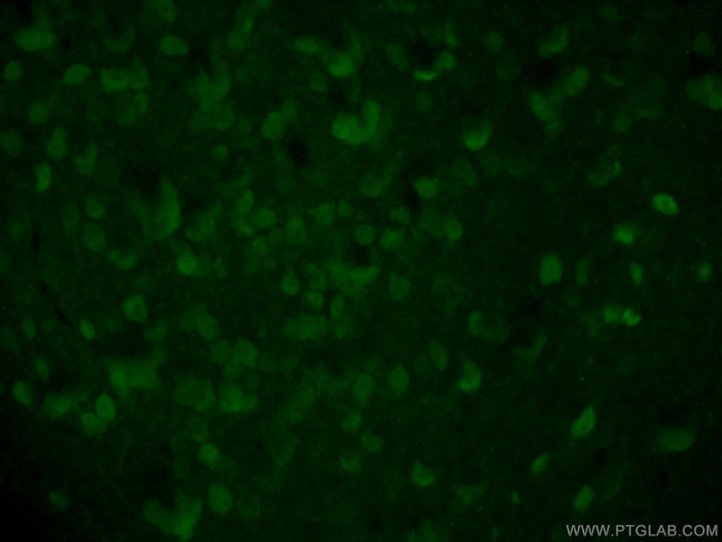 Calbindin-D28k Antibody in Immunohistochemistry (PFA fixed) (IHC (PFA))