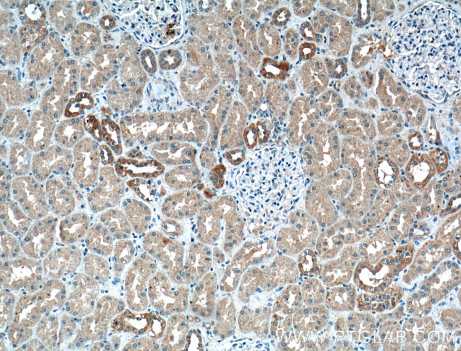 Calbindin-D28k Antibody in Immunohistochemistry (Paraffin) (IHC (P))