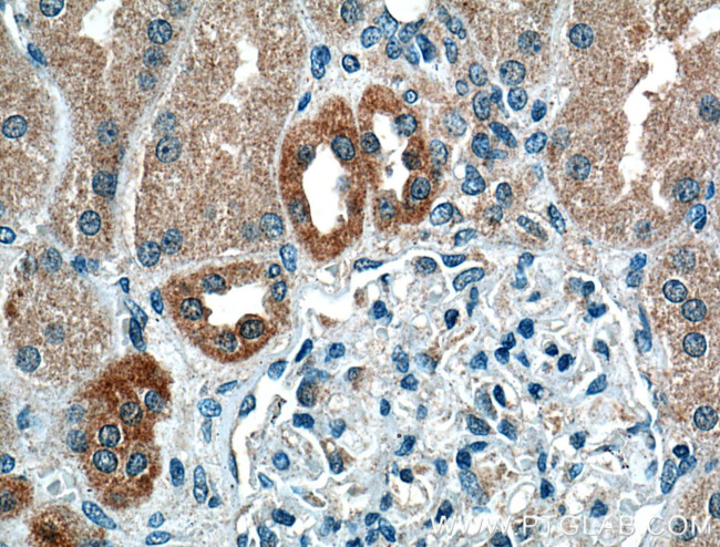 Calbindin-D28k Antibody in Immunohistochemistry (Paraffin) (IHC (P))