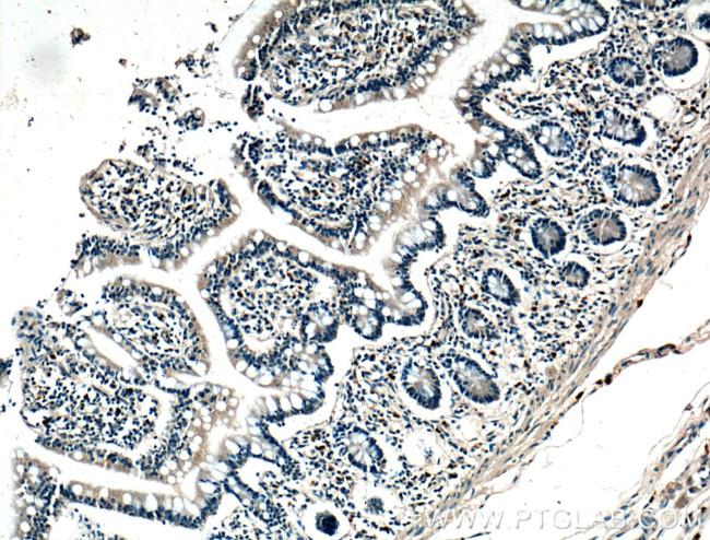 Calbindin-D28k Antibody in Immunohistochemistry (Paraffin) (IHC (P))