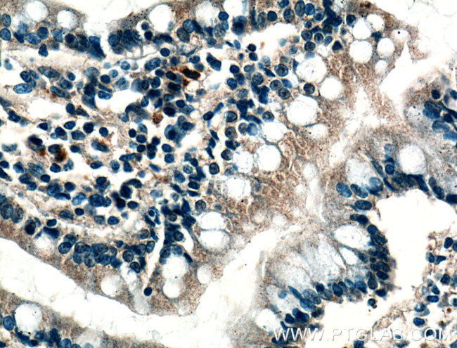 Calbindin-D28k Antibody in Immunohistochemistry (Paraffin) (IHC (P))