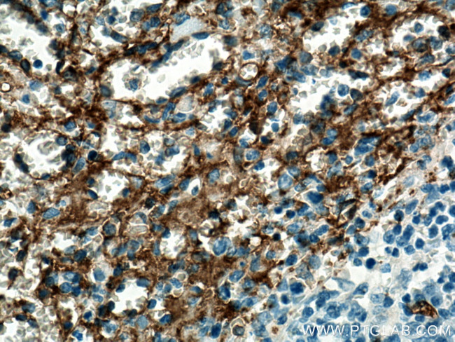 CD36 Antibody in Immunohistochemistry (Paraffin) (IHC (P))