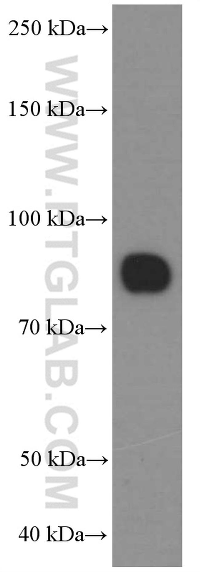 CD36 Antibody in Western Blot (WB)