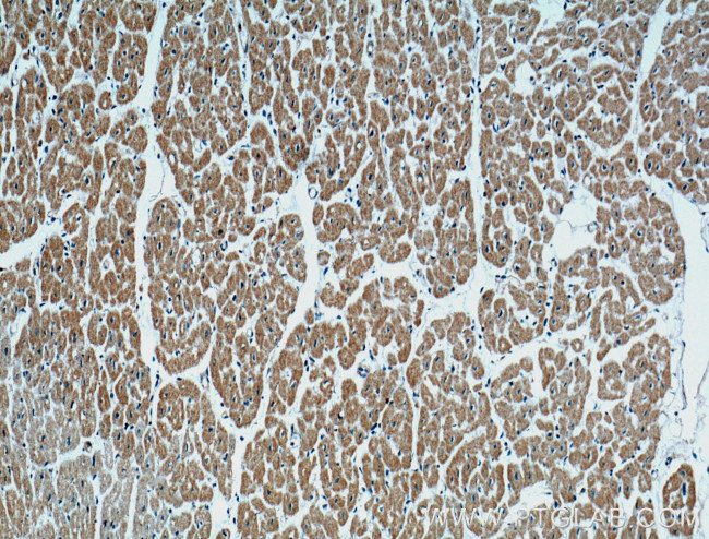 CD36 Antibody in Immunohistochemistry (Paraffin) (IHC (P))