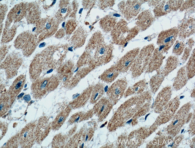 CD36 Antibody in Immunohistochemistry (Paraffin) (IHC (P))