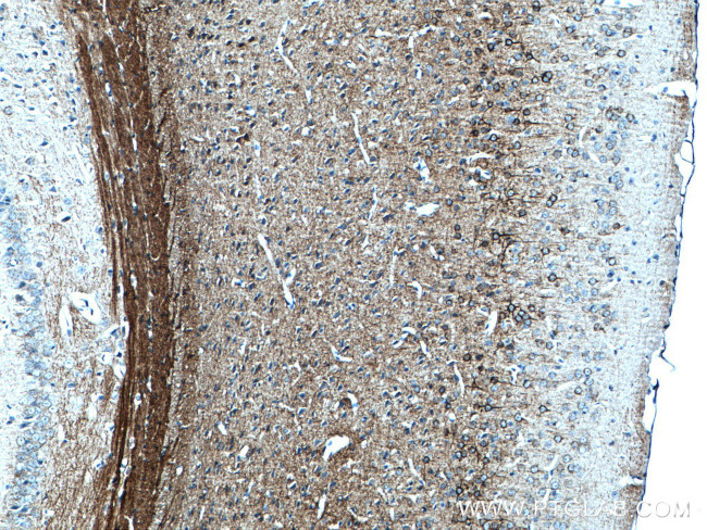 NF-M Antibody in Immunohistochemistry (Paraffin) (IHC (P))