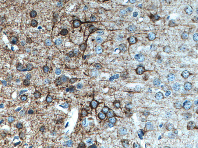 NF-M Antibody in Immunohistochemistry (Paraffin) (IHC (P))