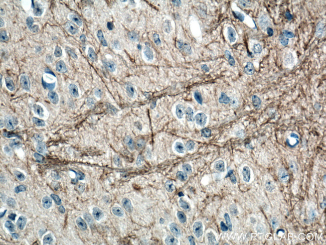 NF-M Antibody in Immunohistochemistry (Paraffin) (IHC (P))