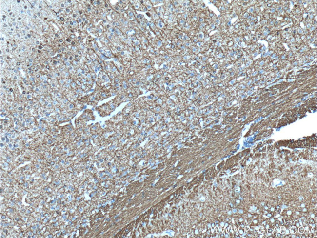 NF-M Antibody in Immunohistochemistry (Paraffin) (IHC (P))