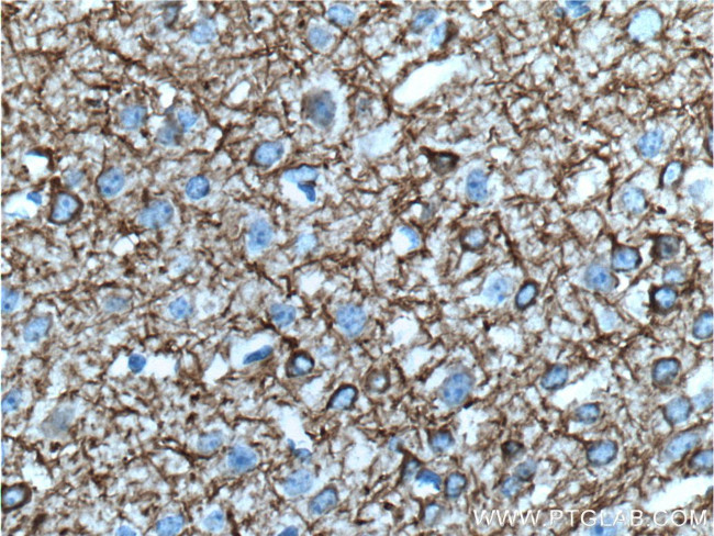 NF-M Antibody in Immunohistochemistry (Paraffin) (IHC (P))