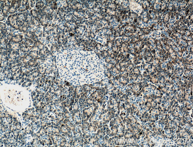 PLA2G1B Antibody in Immunohistochemistry (Paraffin) (IHC (P))