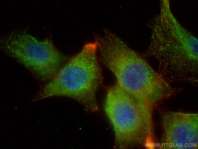 VTN Antibody in Immunocytochemistry (ICC/IF)