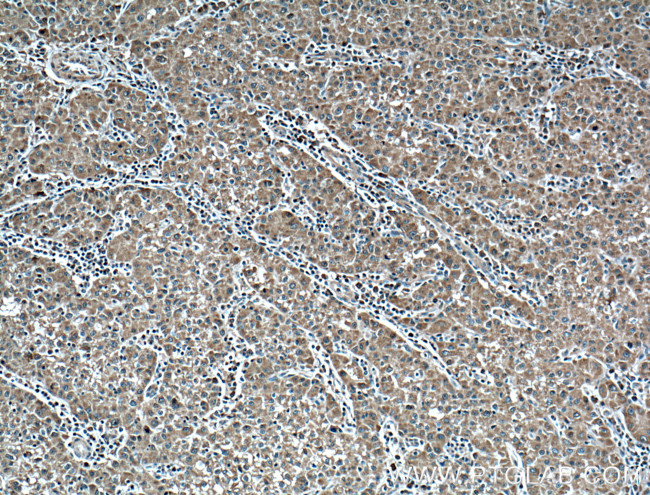 Plasminogen Antibody in Immunohistochemistry (Paraffin) (IHC (P))