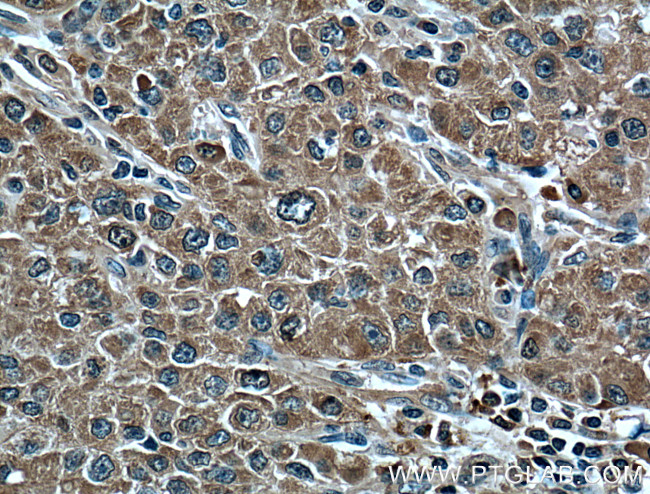 Plasminogen Antibody in Immunohistochemistry (Paraffin) (IHC (P))