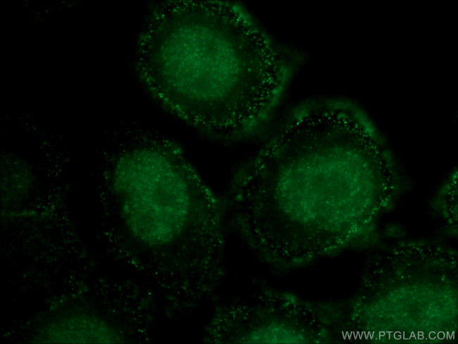 GATA3 Antibody in Immunocytochemistry (ICC/IF)