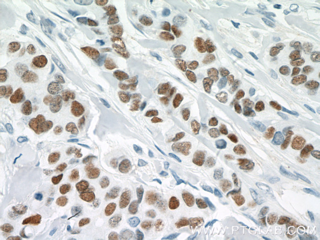 GATA3 Antibody in Immunohistochemistry (Paraffin) (IHC (P))