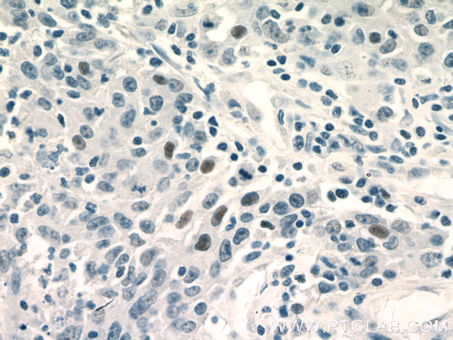 GATA3 Antibody in Immunohistochemistry (Paraffin) (IHC (P))