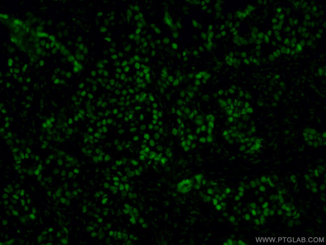 GATA3 Antibody in Immunohistochemistry (PFA fixed) (IHC (PFA))