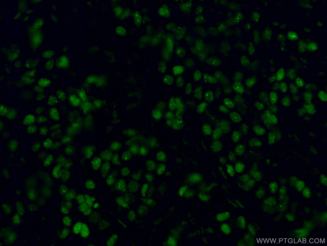 GATA3 Antibody in Immunohistochemistry (PFA fixed) (IHC (PFA))