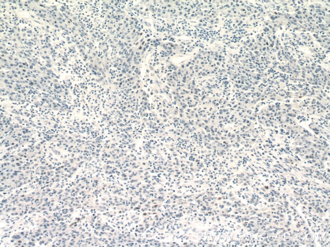 GATA3 Antibody in Immunohistochemistry (Paraffin) (IHC (P))