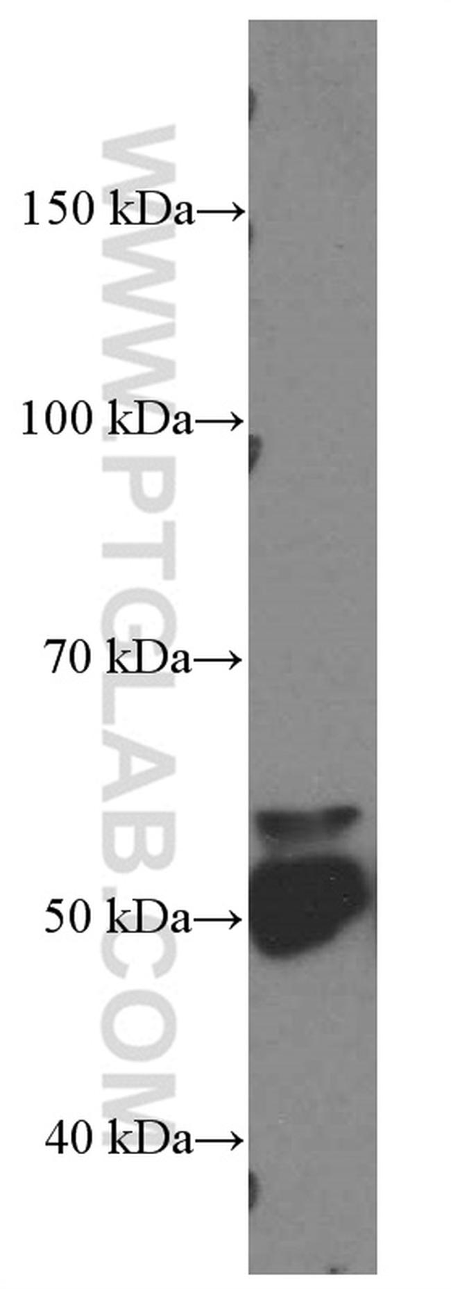 GATA3 Antibody in Western Blot (WB)