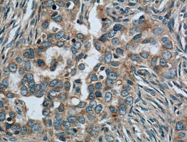 CALCOCO2 Antibody in Immunohistochemistry (Paraffin) (IHC (P))