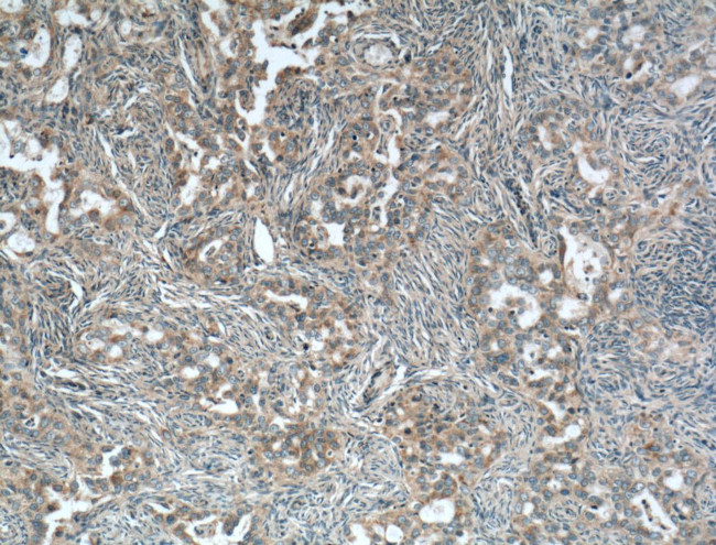 CALCOCO2 Antibody in Immunohistochemistry (Paraffin) (IHC (P))