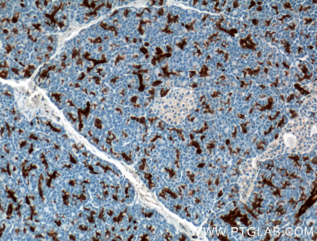 Annexin A3 Antibody in Immunohistochemistry (Paraffin) (IHC (P))