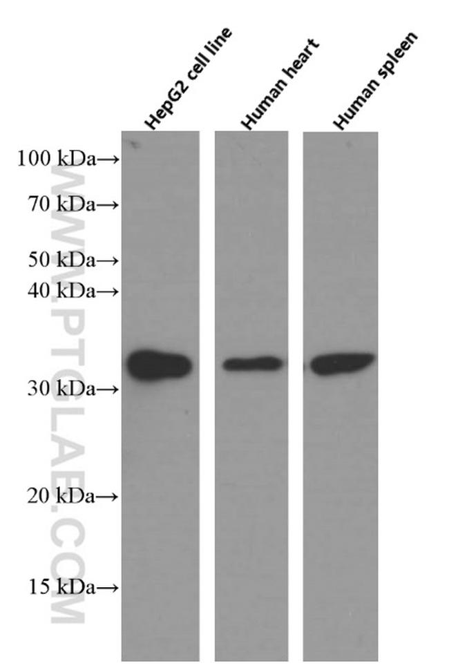 Annexin A3 Antibody in Western Blot (WB)