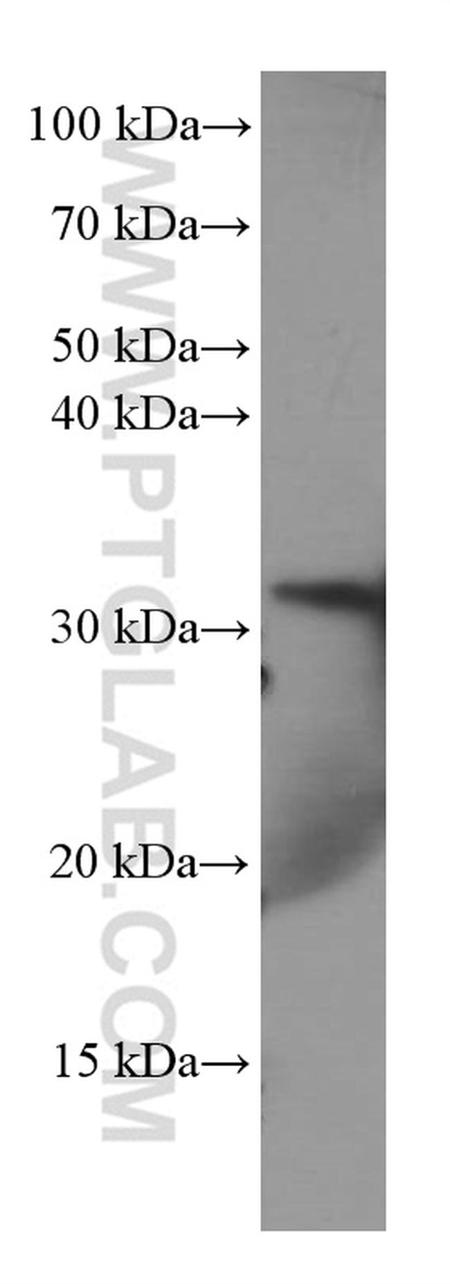 Annexin A3 Antibody in Western Blot (WB)