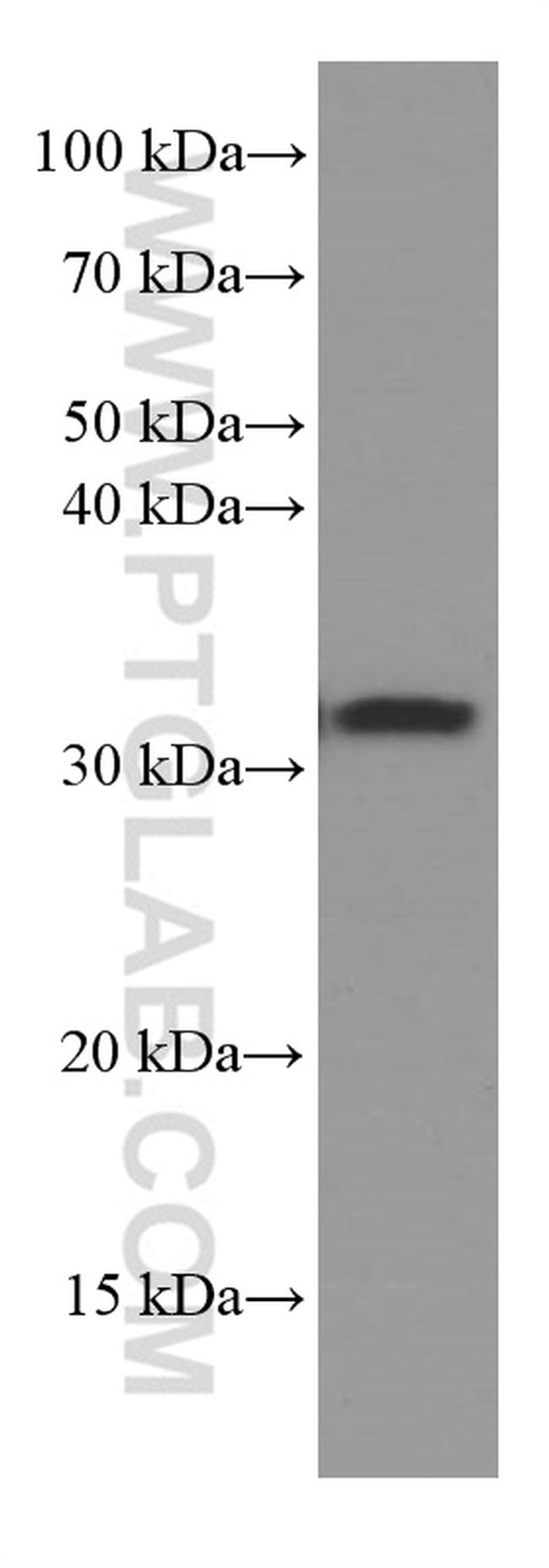 Annexin A3 Antibody in Western Blot (WB)