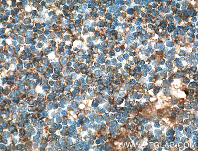 CD80/B7-1 Antibody in Immunohistochemistry (Paraffin) (IHC (P))