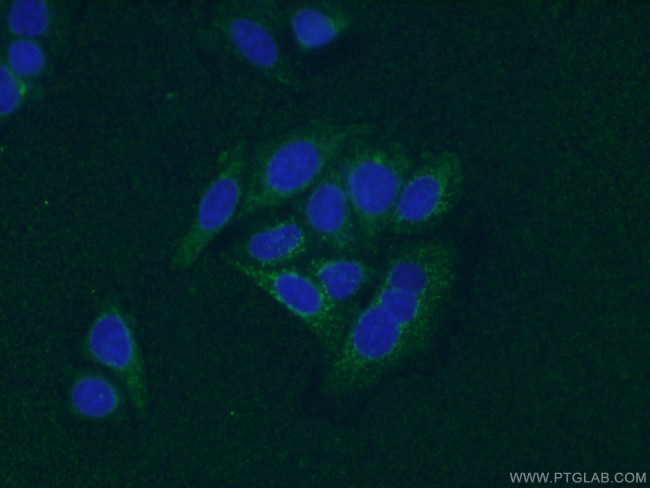 SIRT2 Antibody in Immunocytochemistry (ICC/IF)