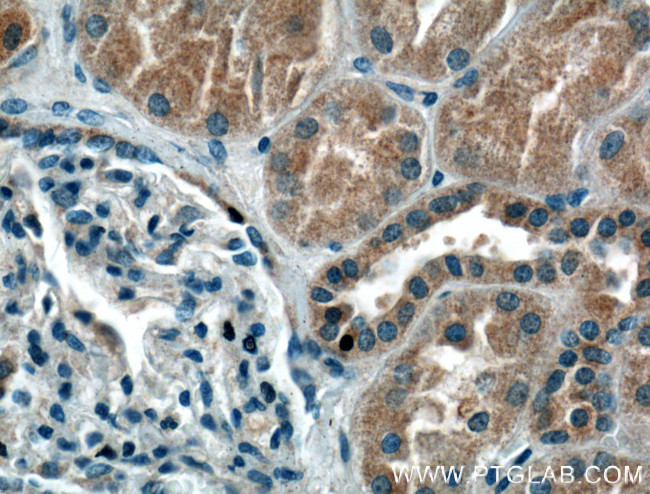 SIRT2 Antibody in Immunohistochemistry (Paraffin) (IHC (P))