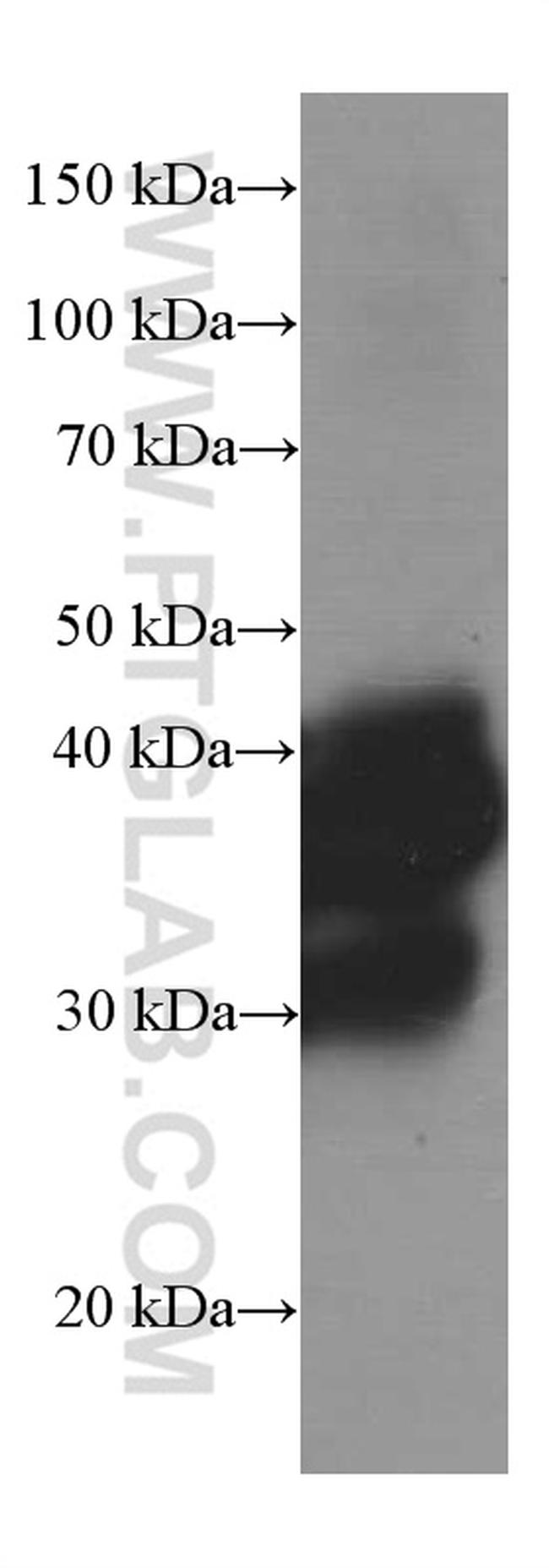 SIRT2 Antibody in Western Blot (WB)