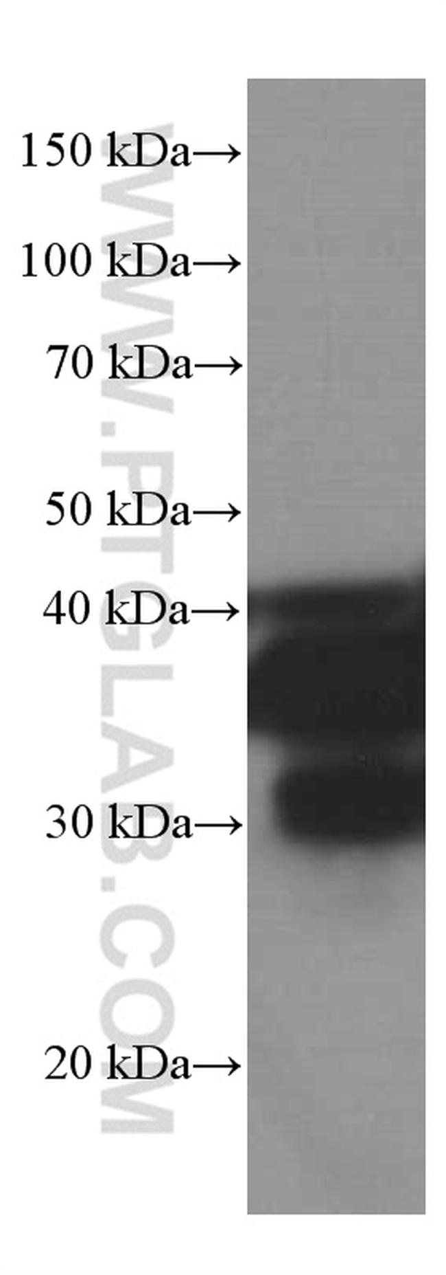 SIRT2 Antibody in Western Blot (WB)