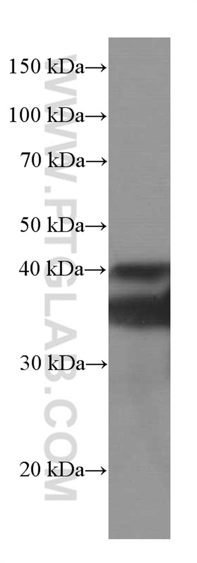 SIRT2 Antibody in Western Blot (WB)