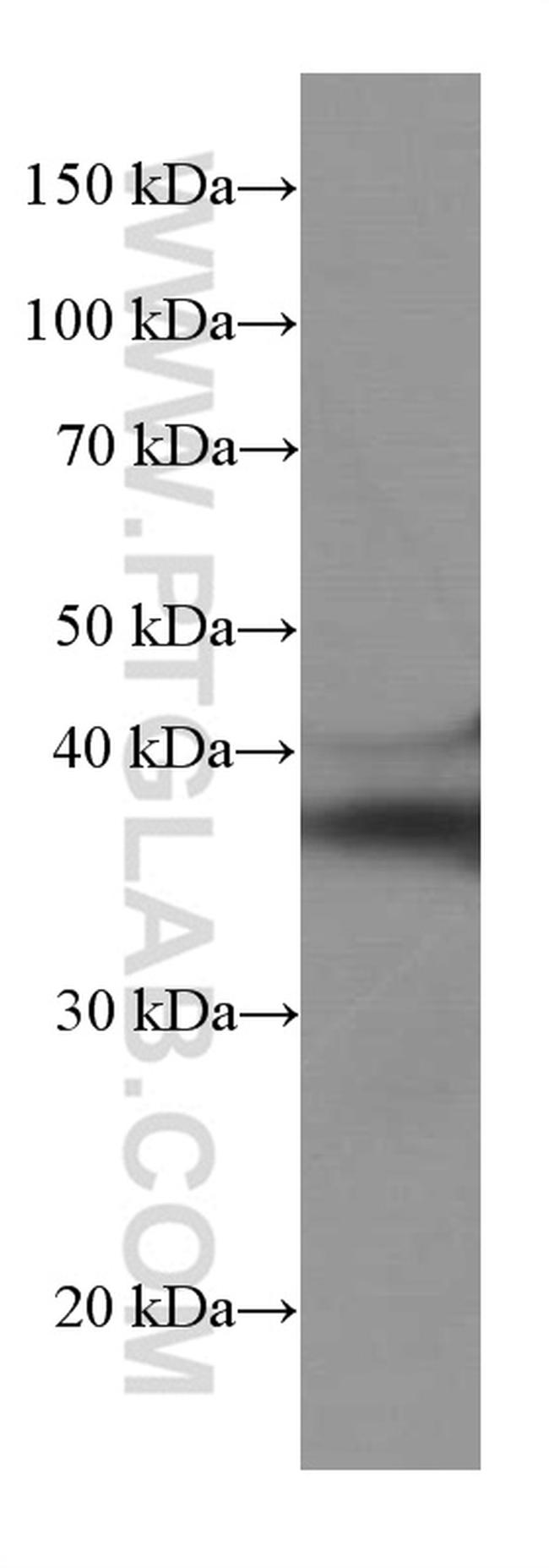 SIRT2 Antibody in Western Blot (WB)