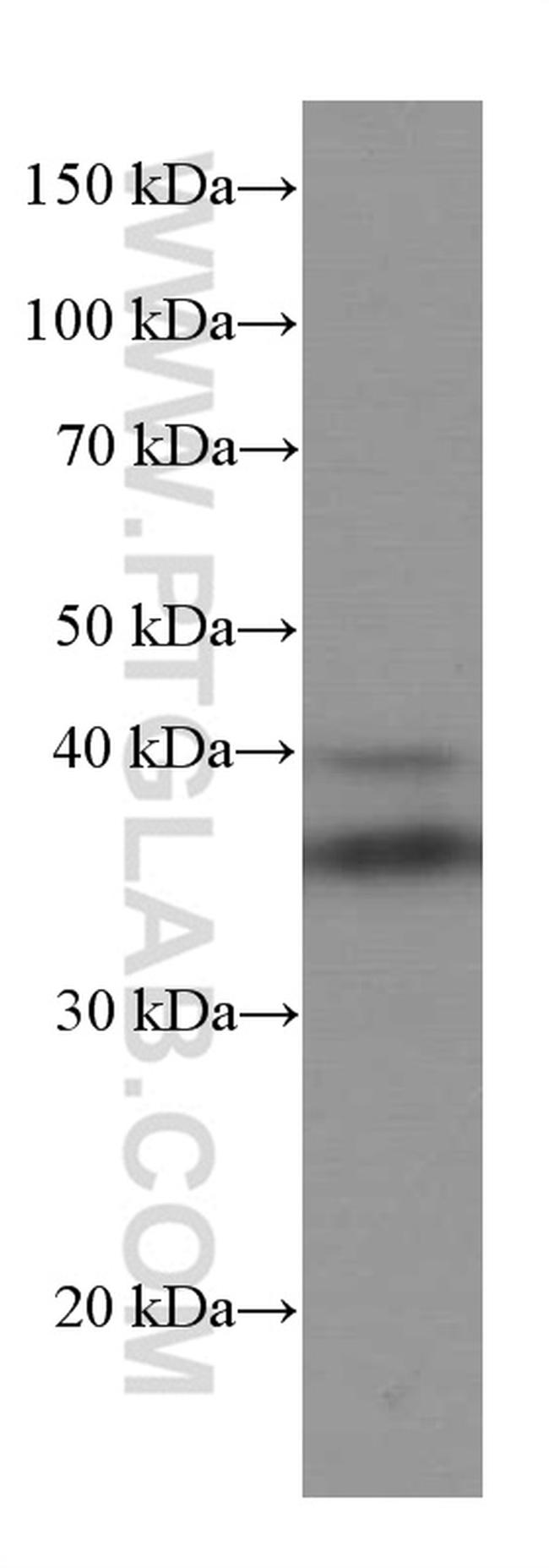 SIRT2 Antibody in Western Blot (WB)