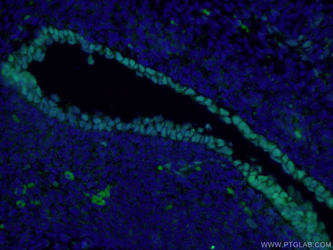 SOX2 Antibody in Immunohistochemistry (PFA fixed) (IHC (PFA))