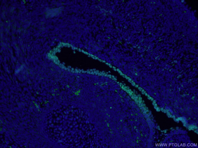 SOX2 Antibody in Immunohistochemistry (PFA fixed) (IHC (PFA))