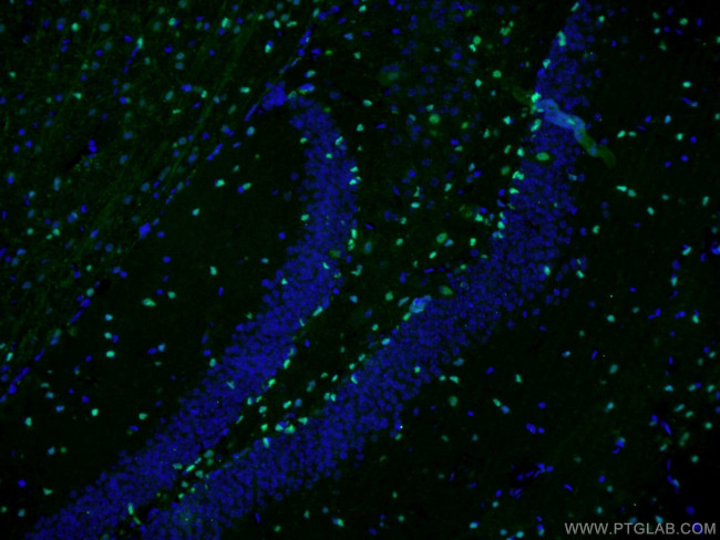 SOX2 Antibody in Immunohistochemistry (PFA fixed) (IHC (PFA))